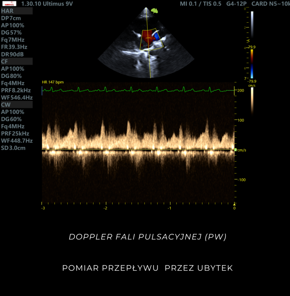 Złożona wada serca u kota -ASD, TVD - Norax Medical - dystrybutor ...